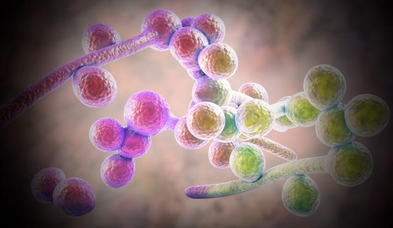 Candida albicans: Ein unterschätzter Faktor in der Progression von Hautkrebs