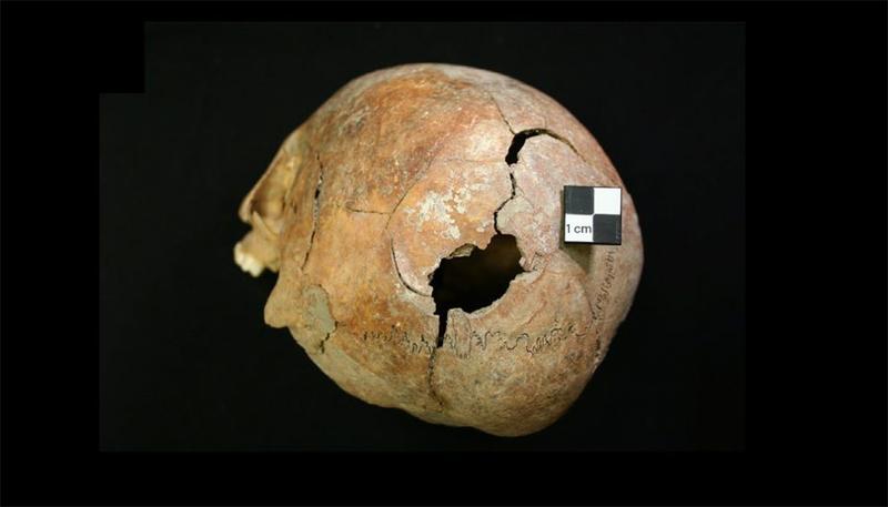 Ein rätselhaftes Massaker: Neue Erkenntnisse über ein eisenzeitliches Massengrab in Serbien