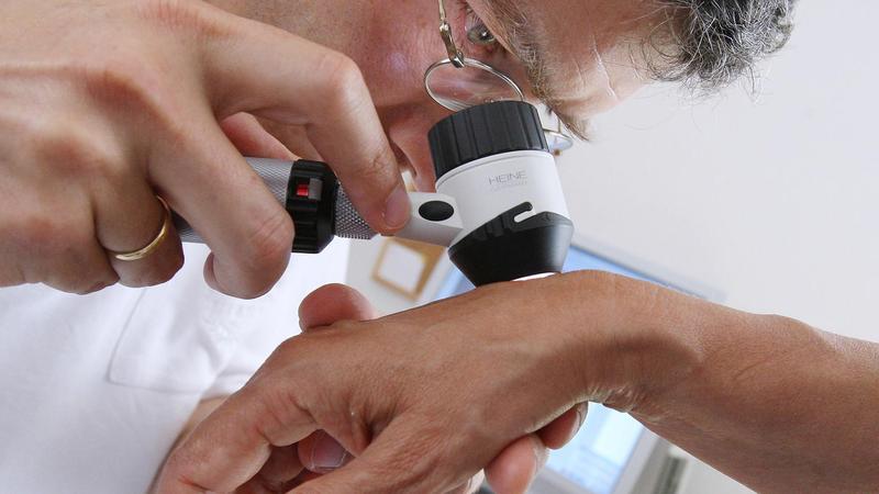 Hautkrebsvorsorge: Sollte sie abgeschafft werden?