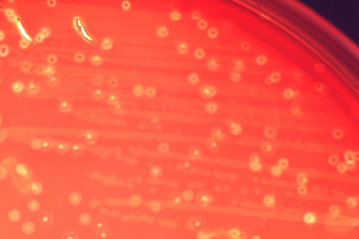 Streptococcus anginosus: Ein Mundbakterium als Risikofaktor für Magenkrebs